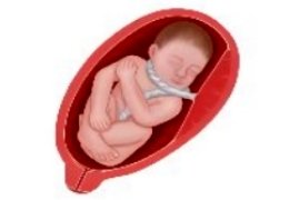 Circular del Cordón Umbilical